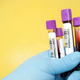 Imagen para el artículo titulado Un nuevo análisis de sangre detecta cinco tipos de cáncer cuatro años antes que los métodos convencionales